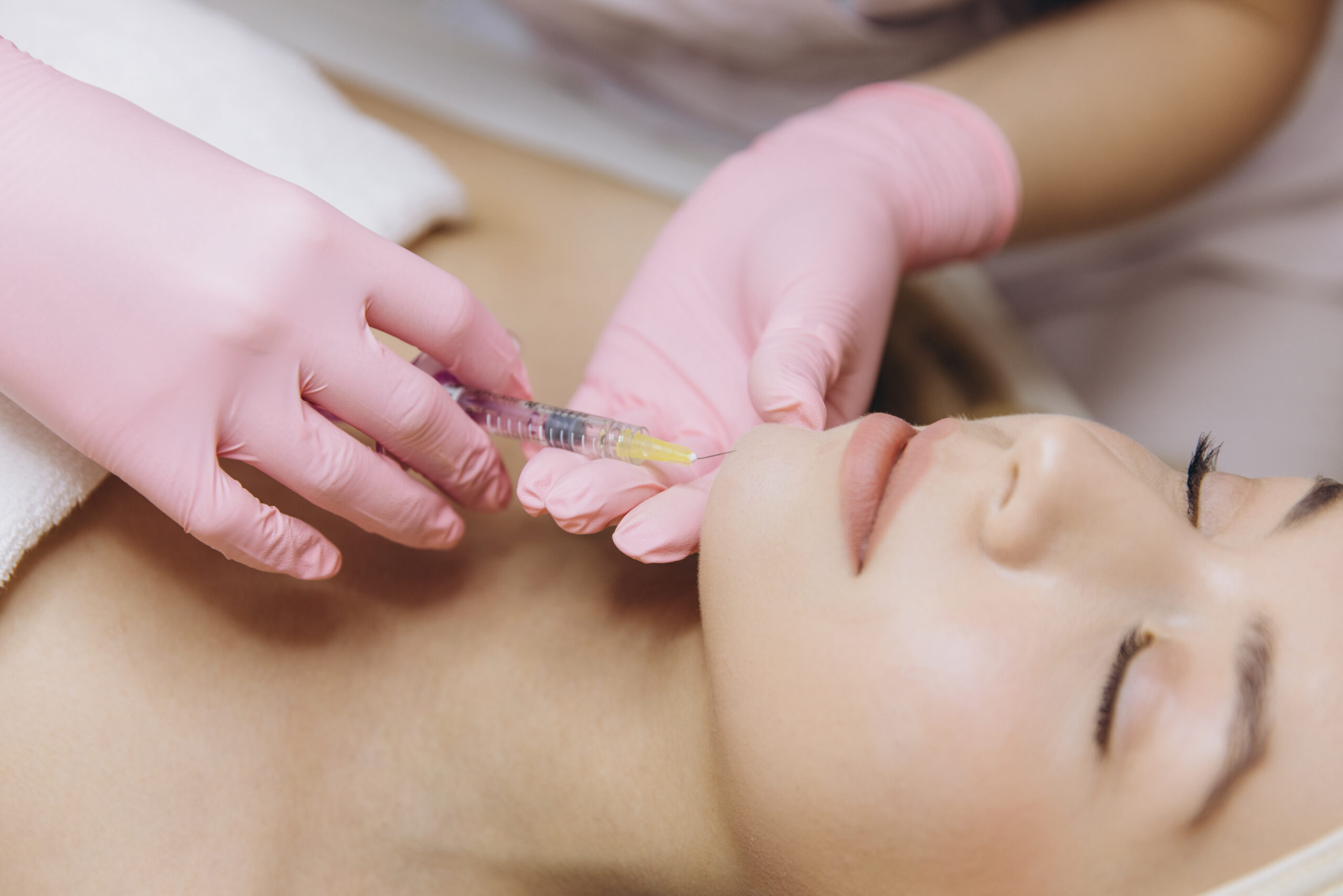 Radiesse collagen-stimulating filler treatment in Vienna, VA